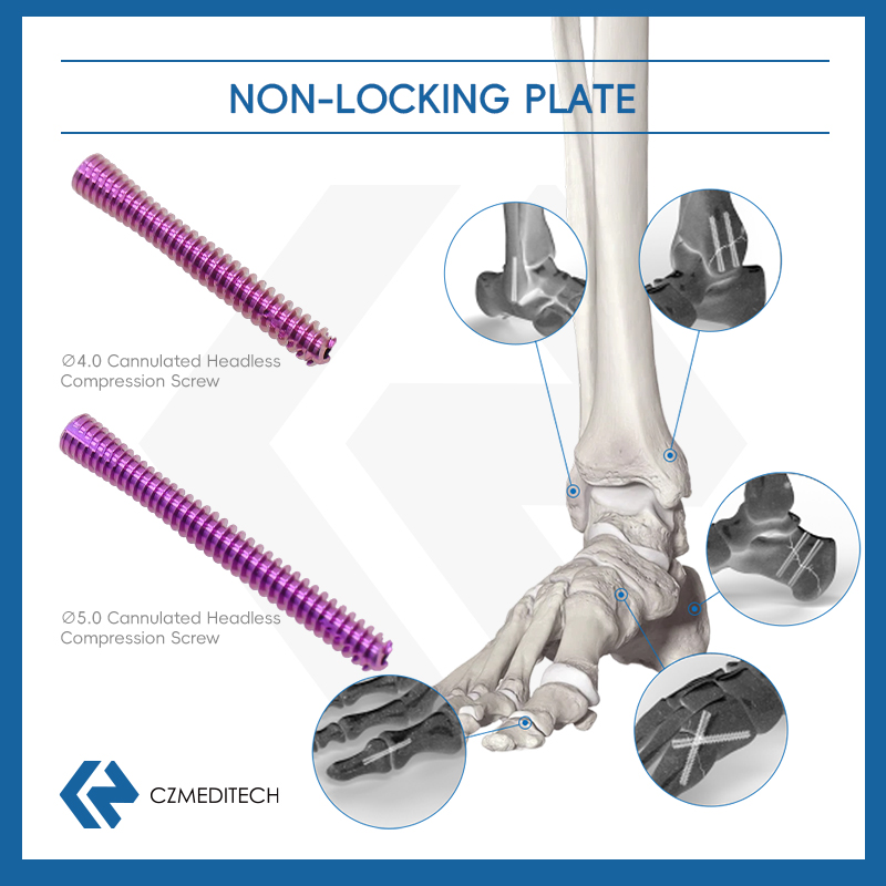 herbert cannulated compression screw