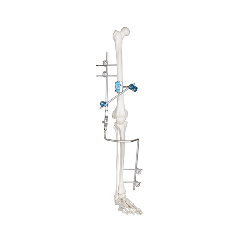knee joint external fixator 41699450