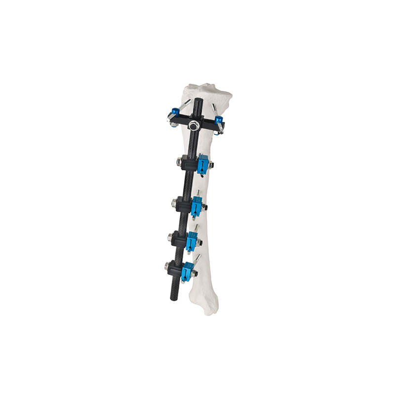 t type external fixator 8100 12