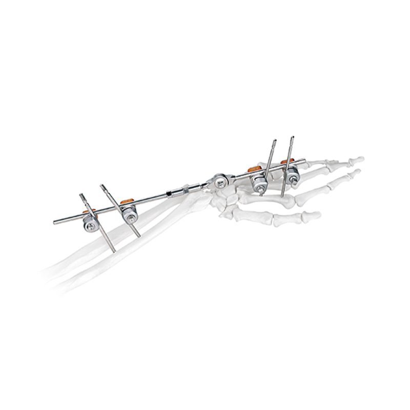 wrist joint external fixator