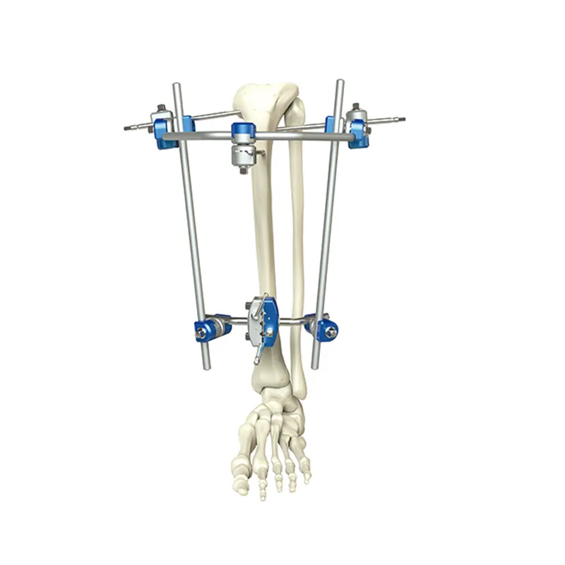 proximal tibia external fixator