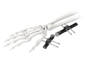 3d type external fixator