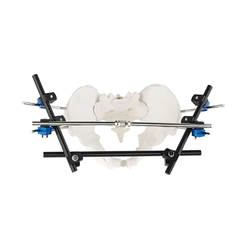 pelvic fixator external fixator