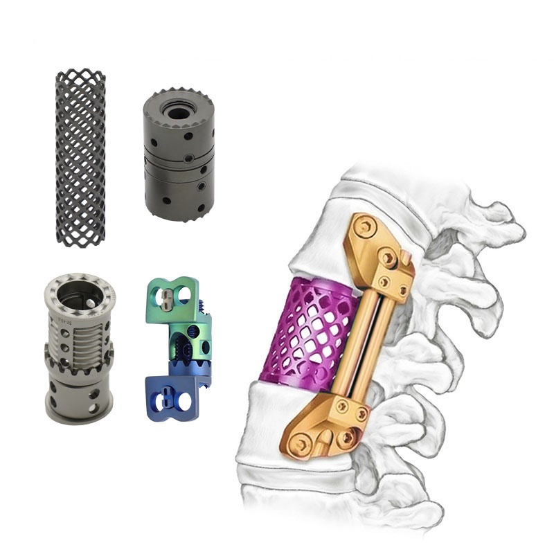 titanium mesh cage