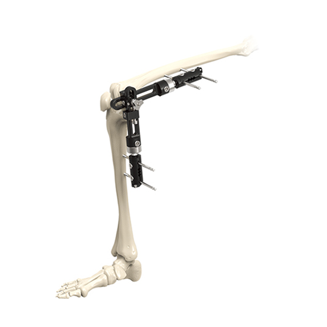 knee joint external fixator 45831450