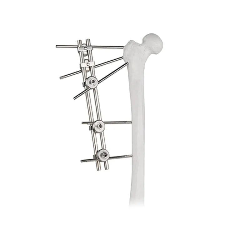double rods tuberosity external fixator