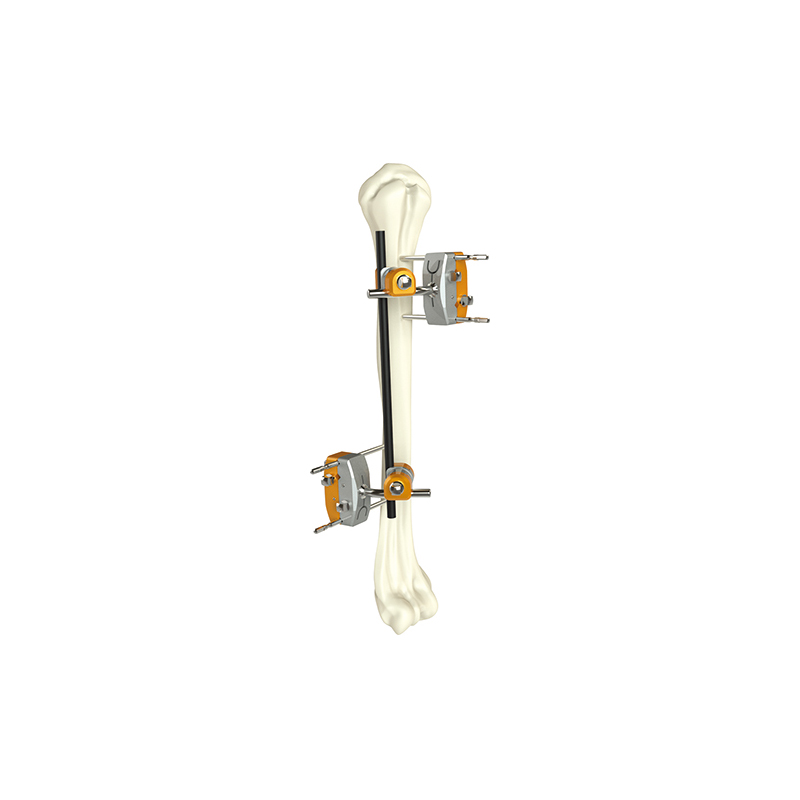 humeral shaft external fixator