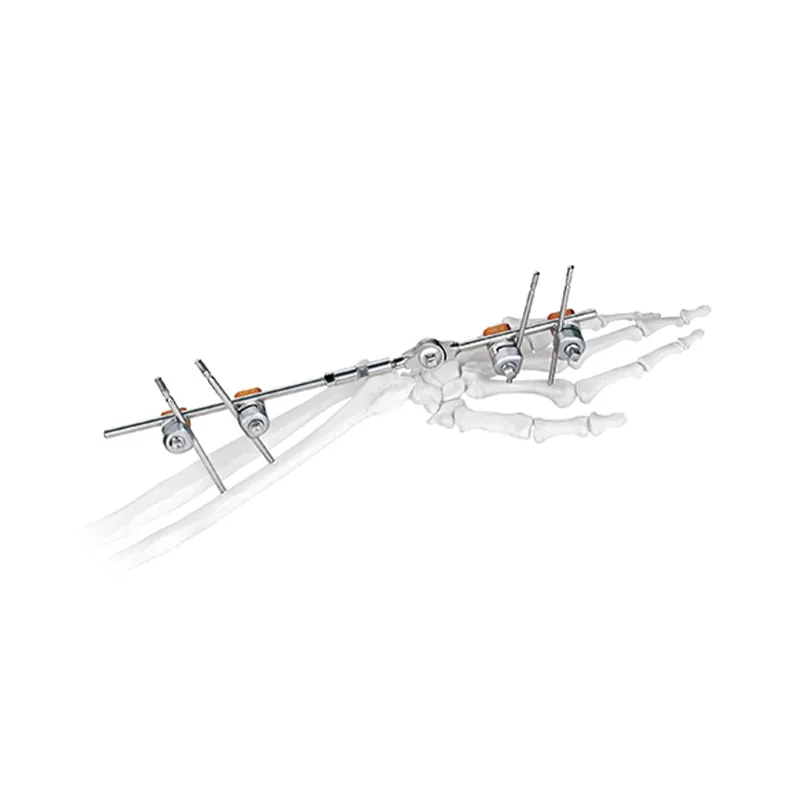 wrist joint external fixator