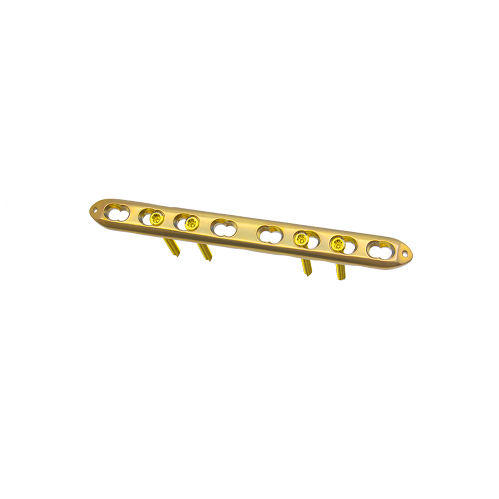 ulna radius locking plate