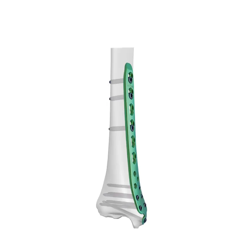 distal medial tibial locking plate i