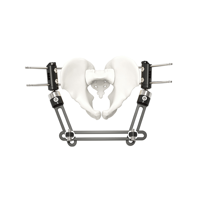pelvic fragment external fixator type a