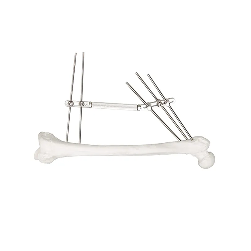 dynamic external fixator