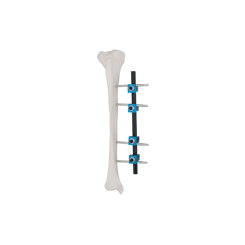 straight type external fixator 8100 14