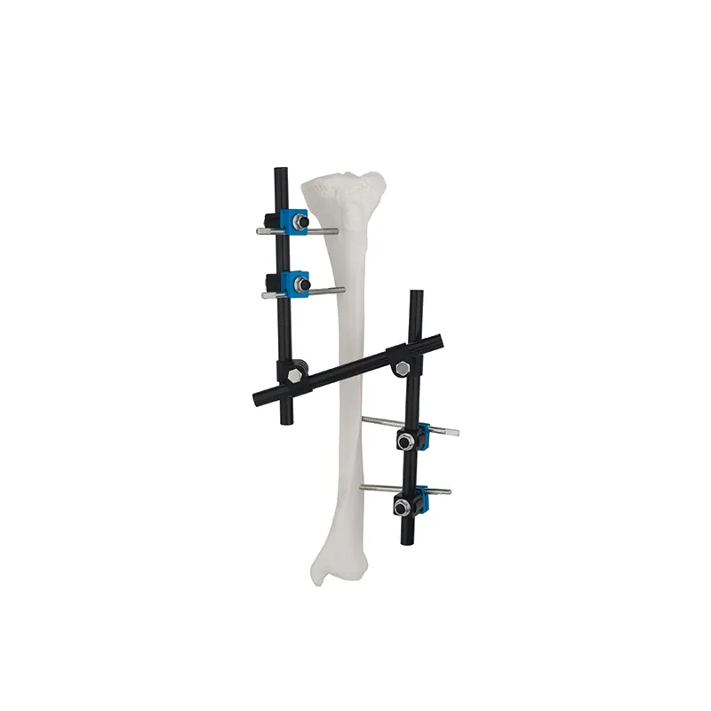 z type enhancement mode external fixator