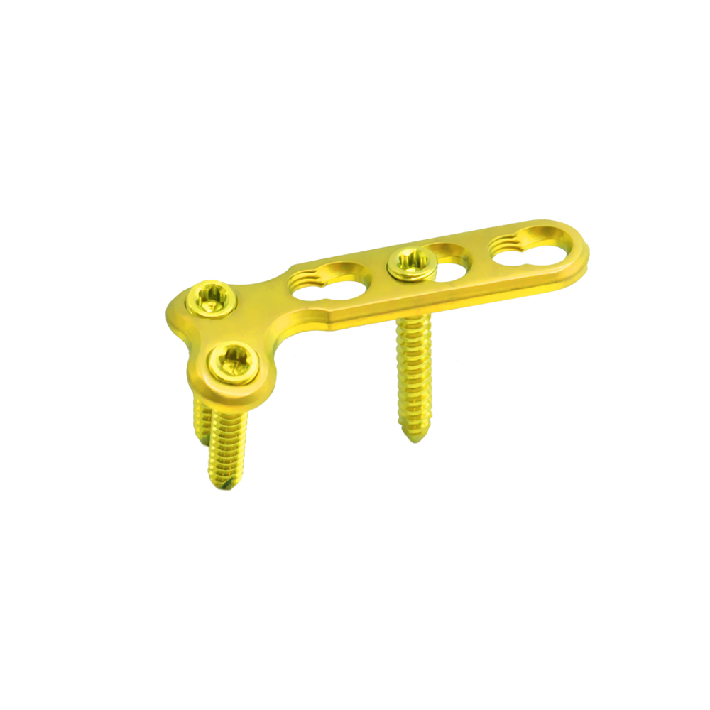 2 7 mm mini l locking plate