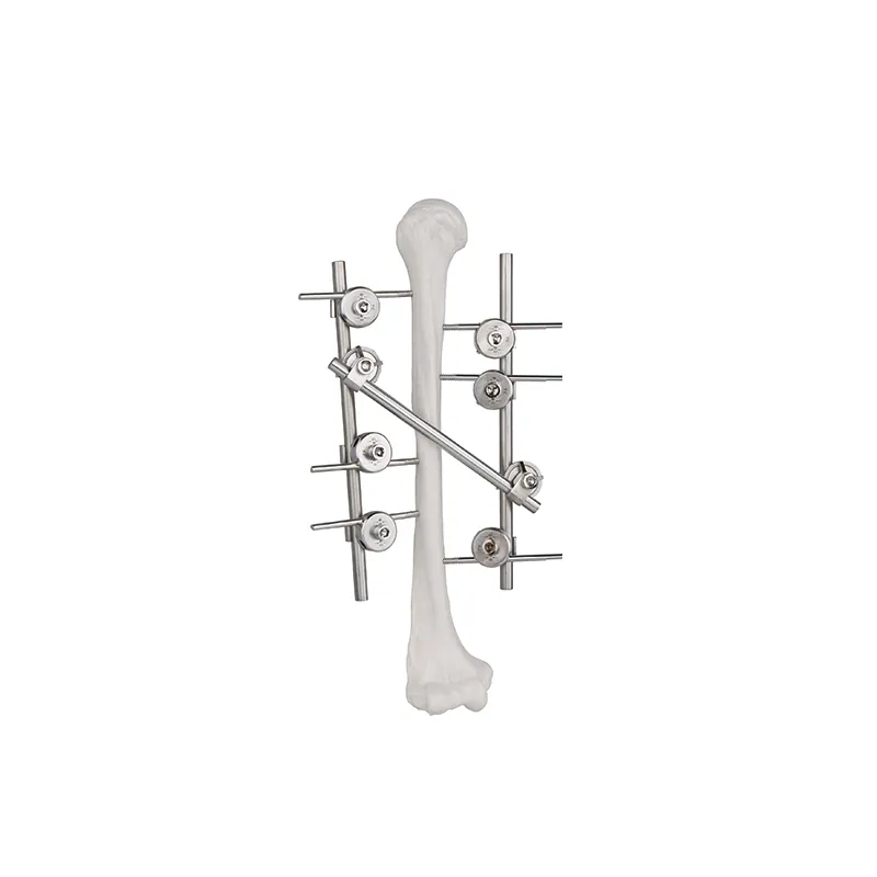 humeral frame external fixator