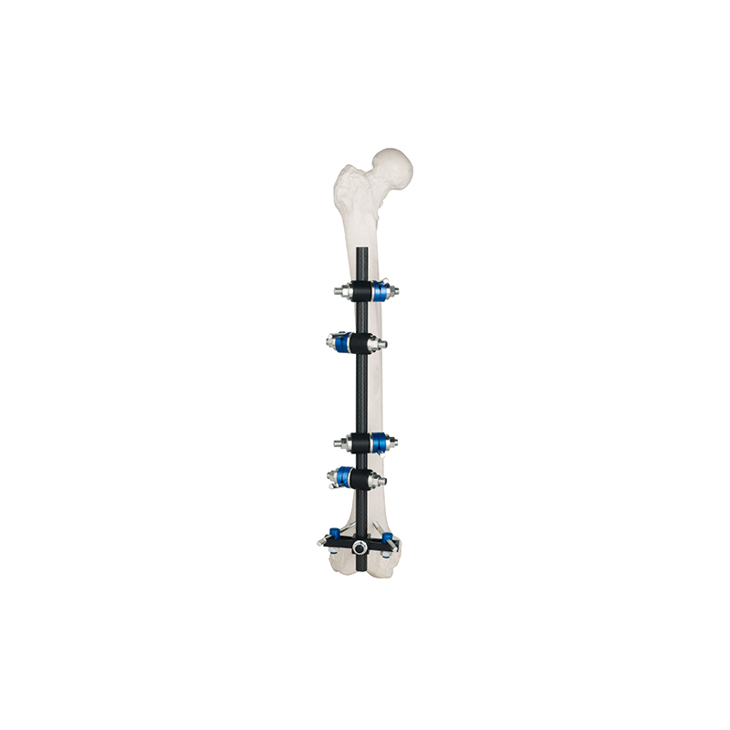 t frame external fixator