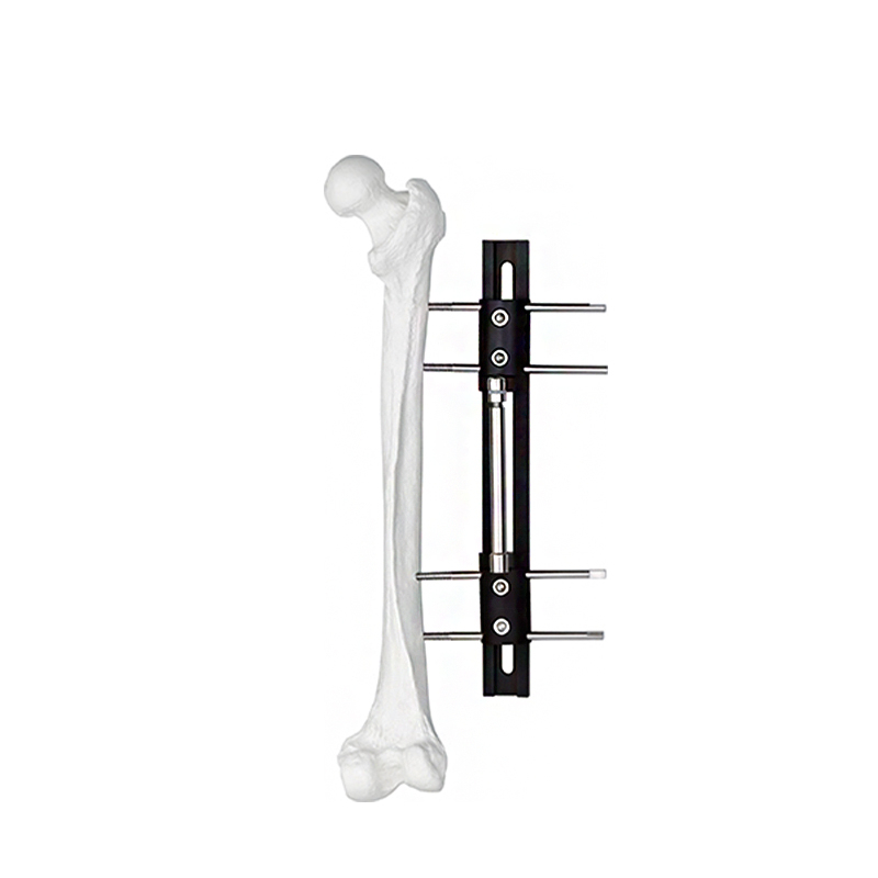 bone lengthening external fixator typ a