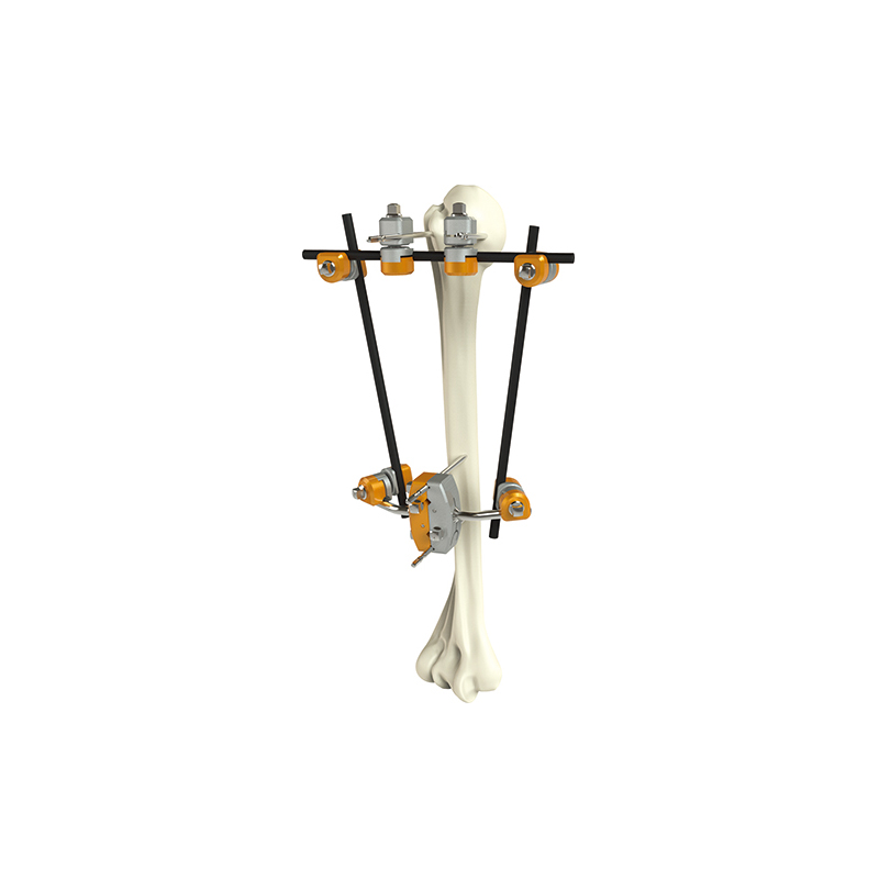 proximal humerus external fixator