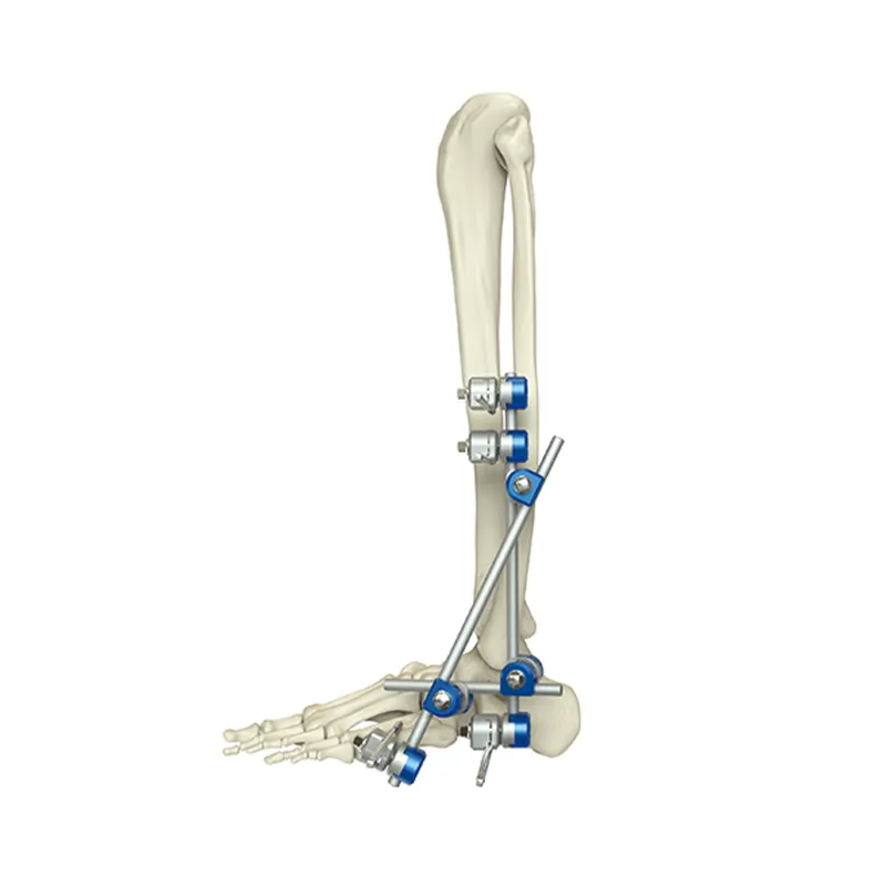 ankle joint external fixator