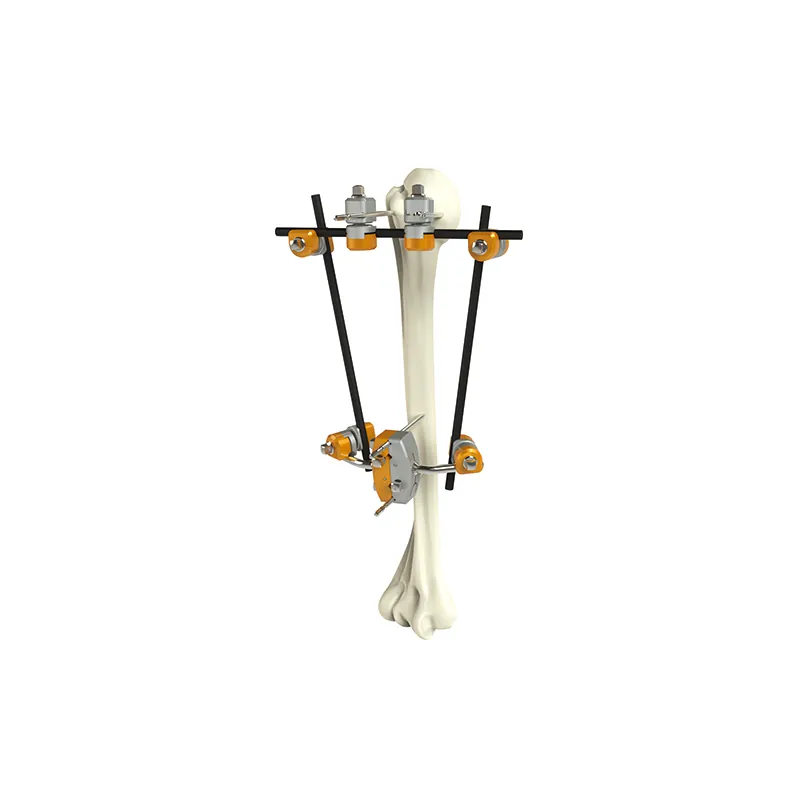 proximal humerus external fixator