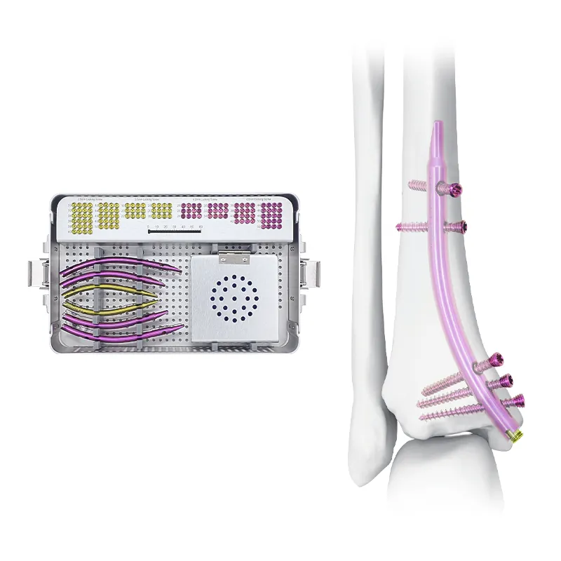 distal tibial intramedullary nail dtn box 1000 0139