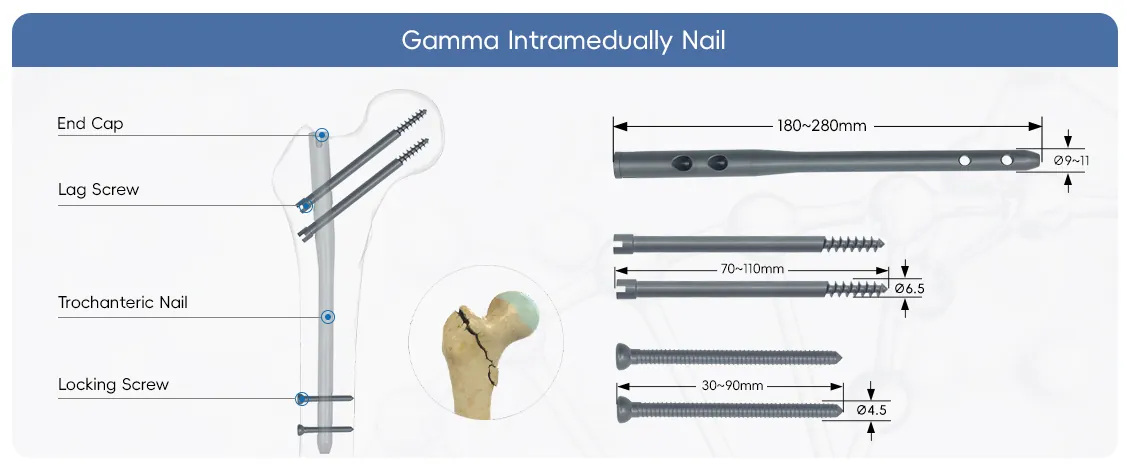 gamma nail