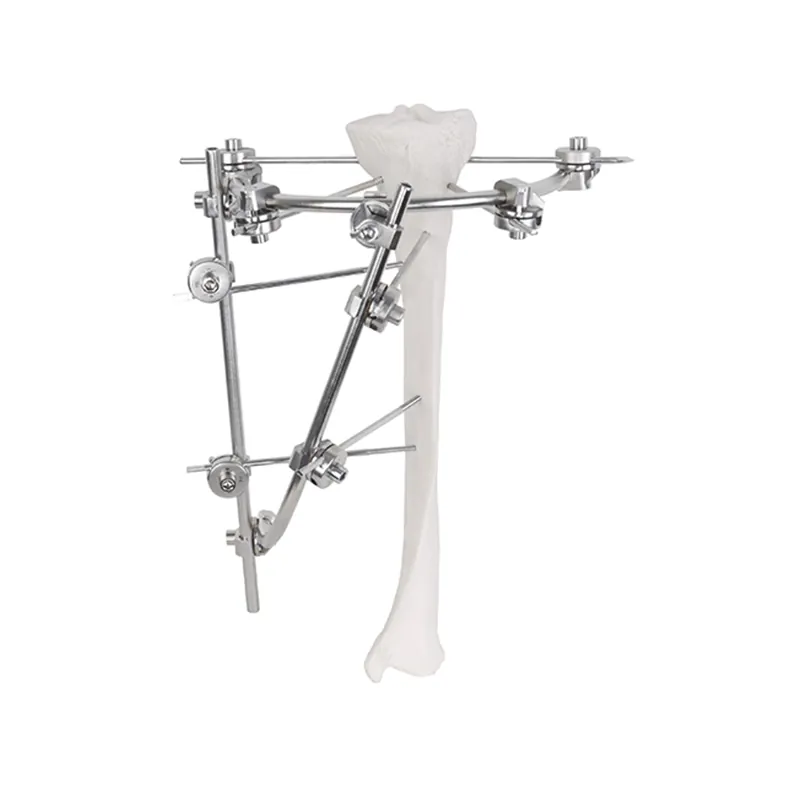 tibial plateau frame external fixator