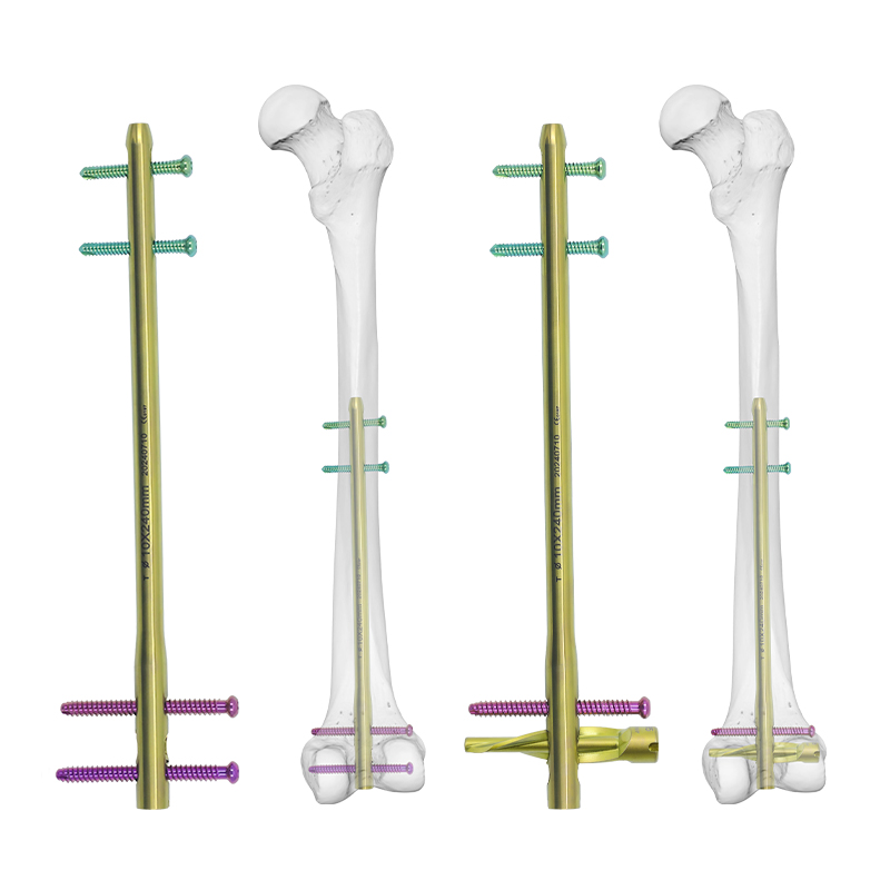 dfn distal femur intramedullary nail t1100 46