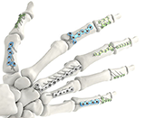 2.7mm LCP Pediatric Straight Plate - 4