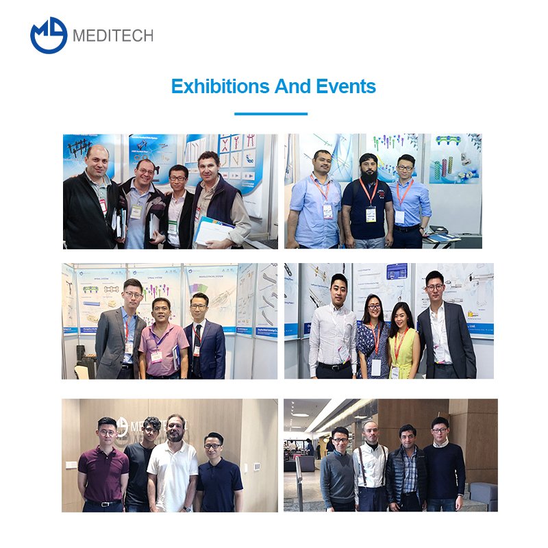 1.5MM X-type Locking Plate Maxillofacial Plate - 4