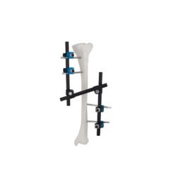 Z Type(Enhancement Mode) External Fixator